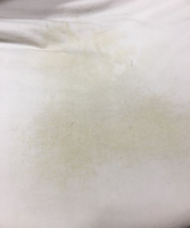 被子上为什么会有黄斑