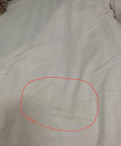 蚕丝被时间长了为何面料上有黄点呢
