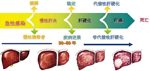 关于乙肝的一些常识（乙肝常见的12个问题）(4)