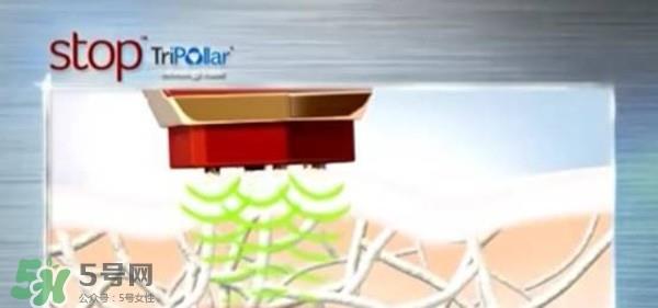 tripollar stop怎么样？tripollar pose好用吗