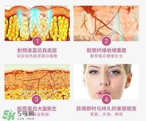 tripollar stop怎么样？tripollar pose好用吗
