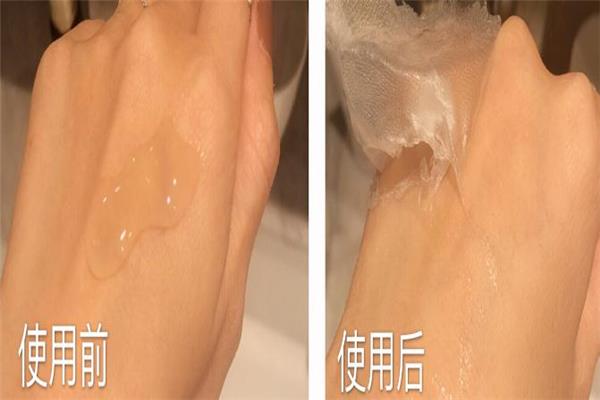 乾佰纳生物膜多少钱 医用生物修复膜
