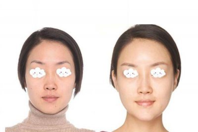 ​如何拥有苹果肌呢 苹果肌都是天生的吗