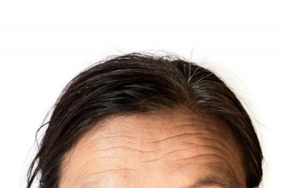 ​抬头纹是天生的吗还是后天的 抬头纹是遗传的吗