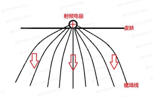射频美容仪原理是什么 皮薄敏感肌不适合用