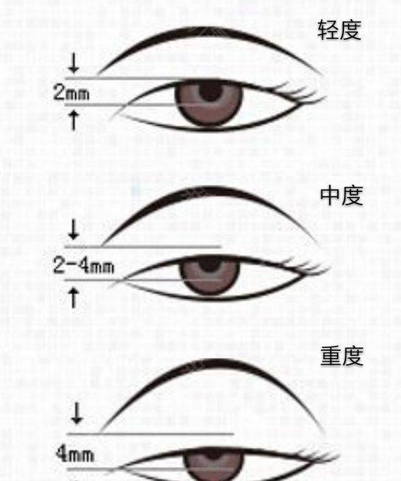 变废为宝项目，废木料变废为宝的项目？图3